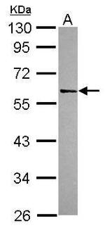 SMAD3 Antibody in Western Blot (WB)