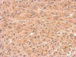 DCTD Polyclonal Antibody