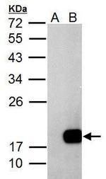 DCTD Antibody in Western Blot (WB)