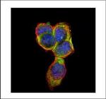 CEA Polyclonal Antibody