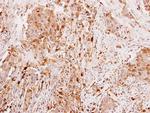 Leptin Polyclonal Antibody