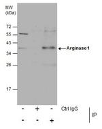 Arginase 1 Antibody in Immunoprecipitation (IP)