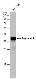 Arginase 1 Antibody in Western Blot (WB)