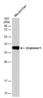 Arginase 1 Antibody in Western Blot (WB)