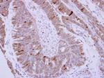 Phospholamban Polyclonal Antibody