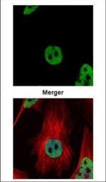 HDAC2 Antibody in Immunocytochemistry (ICC/IF)