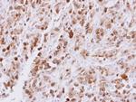 CDT1 Antibody in Immunohistochemistry (Paraffin) (IHC (P))