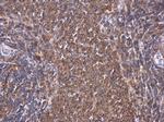 PKC theta Polyclonal Antibody