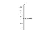 PKC theta Antibody in Western Blot (WB)