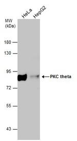 PKC theta Antibody in Western Blot (WB)