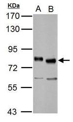 TCF3 Polyclonal Antibody