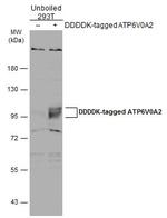 ATP6V0A2 Polyclonal Antibody