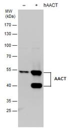 SERPINA3 Polyclonal Antibody