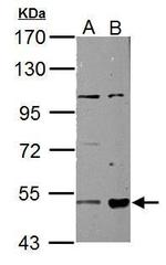 ALDH3A2 Polyclonal Antibody