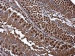 CDK8 Polyclonal Antibody