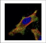 SMAD2 Polyclonal Antibody