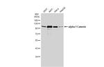 Catenin alpha-1 Antibody in Western Blot (WB)