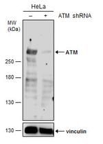ATM Antibody in Western Blot (WB)