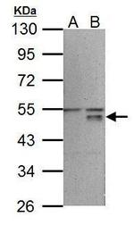 WNT5A Polyclonal Antibody