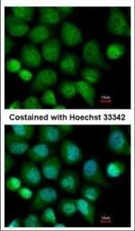CASK Polyclonal Antibody