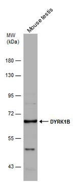 DYRK1B Polyclonal Antibody