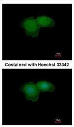 BTK Polyclonal Antibody