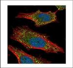 AKT2 Polyclonal Antibody