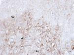 LAMP2 Polyclonal Antibody