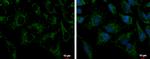 PRDX3 Polyclonal Antibody
