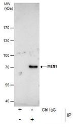 Menin Antibody in Immunoprecipitation (IP)