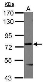 Menin Polyclonal Antibody