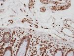 CA150 Antibody in Immunohistochemistry (Paraffin) (IHC (P))