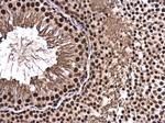 CA150 Antibody in Immunohistochemistry (Paraffin) (IHC (P))