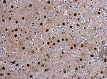 CA150 Antibody in Immunohistochemistry (Paraffin) (IHC (P))