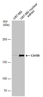 CA150 Antibody in Western Blot (WB)