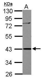 APOBEC3G Polyclonal Antibody