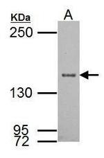SRC1 Polyclonal Antibody