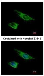 Vimentin Polyclonal Antibody