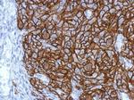 HLA-G Polyclonal Antibody
