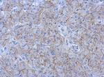 N-cadherin Polyclonal Antibody