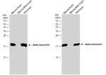 alpha Synuclein Antibody in Western Blot (WB)