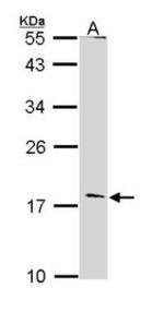 Glucagon Polyclonal Antibody
