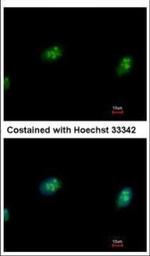CDK4 Antibody in Immunocytochemistry (ICC/IF)