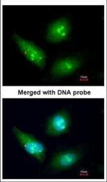 CDK4 Polyclonal Antibody