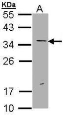 ERCC1 Polyclonal Antibody