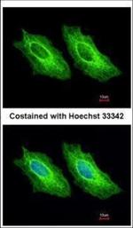 Cytokeratin 18 Antibody in Immunocytochemistry (ICC/IF)