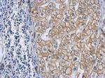 Cytokeratin 18 Antibody in Immunohistochemistry (Paraffin) (IHC (P))