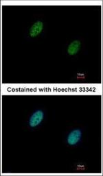 CHK2 Polyclonal Antibody