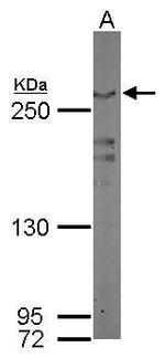 LRRK2 Antibody in Western Blot (WB)