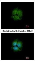 LRRK2 Polyclonal Antibody